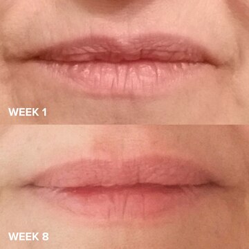 Paula's choice hyaluronic shop acid