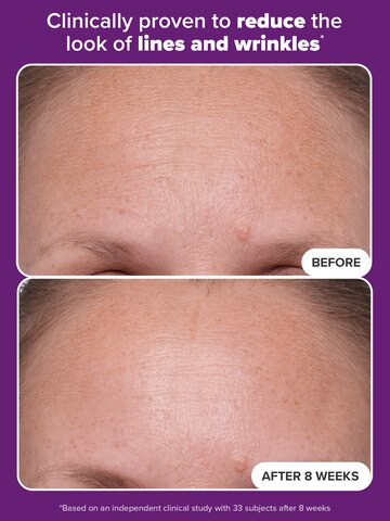 1% Retinol Treatment