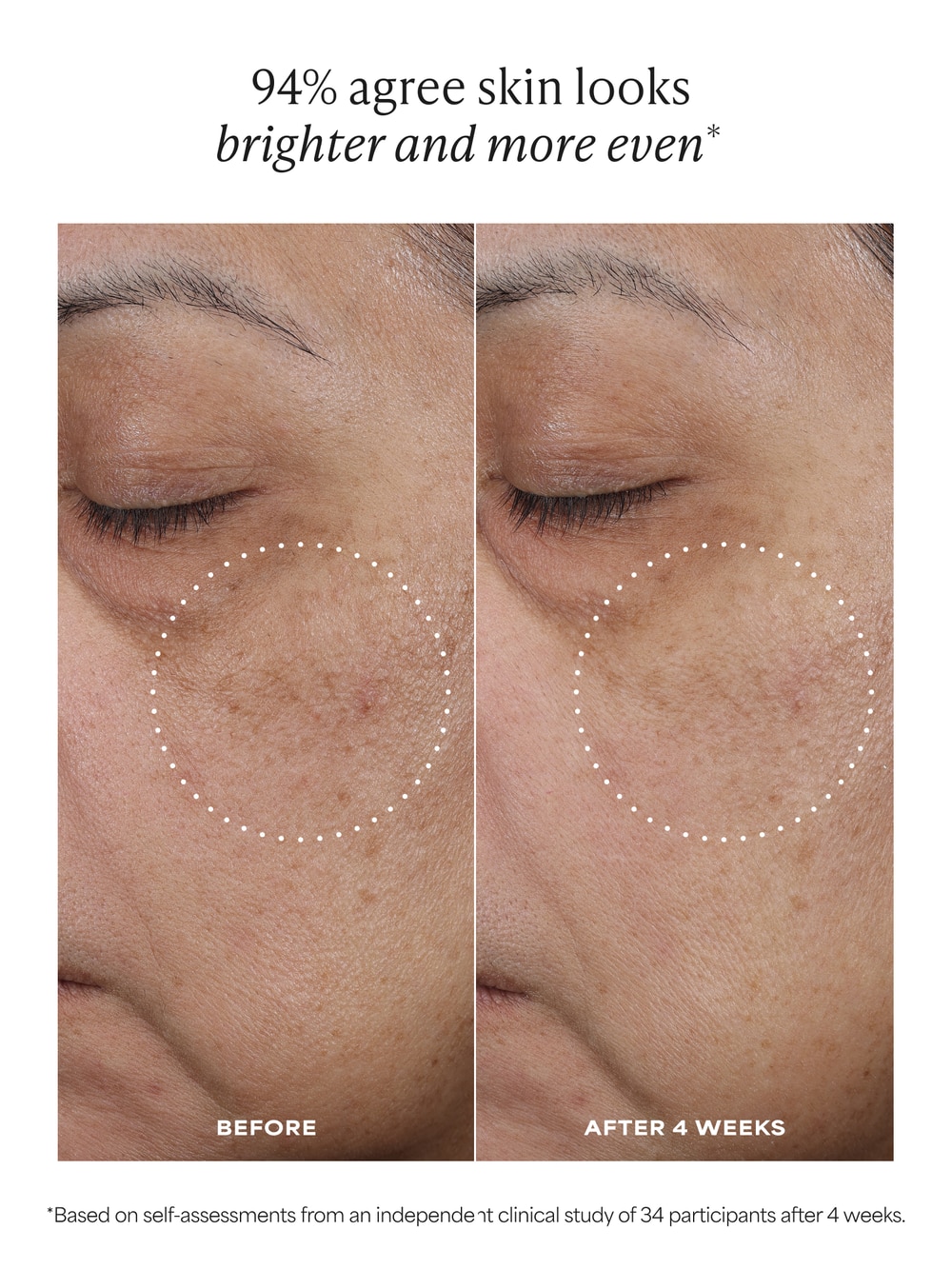 can glutathione change eye color C15 Brightening Super Booster Pack Size:Box of 10 stress fda restrictions on compounding