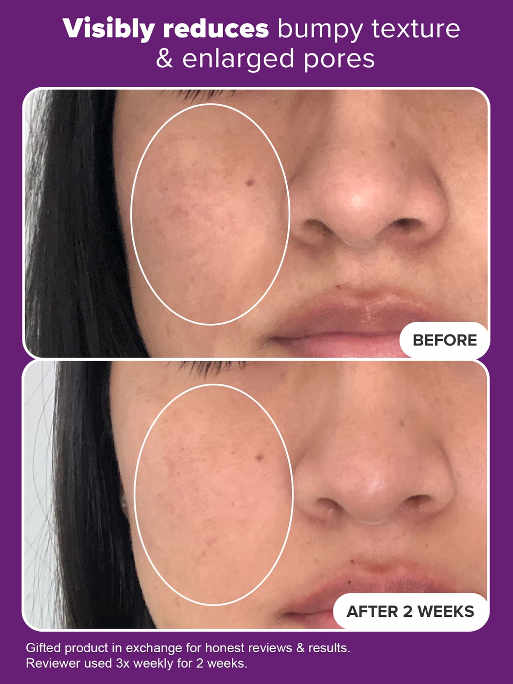 Niacinamide 20% Treatment