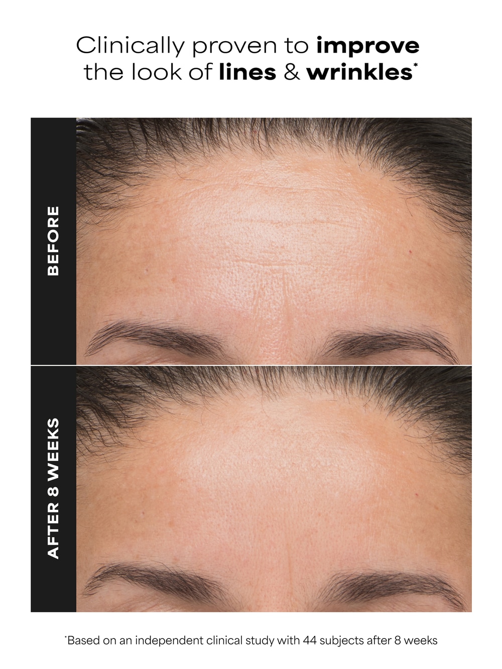 6% Mandelic Acid + 2% Lactic Acid Liquid Exfoliant