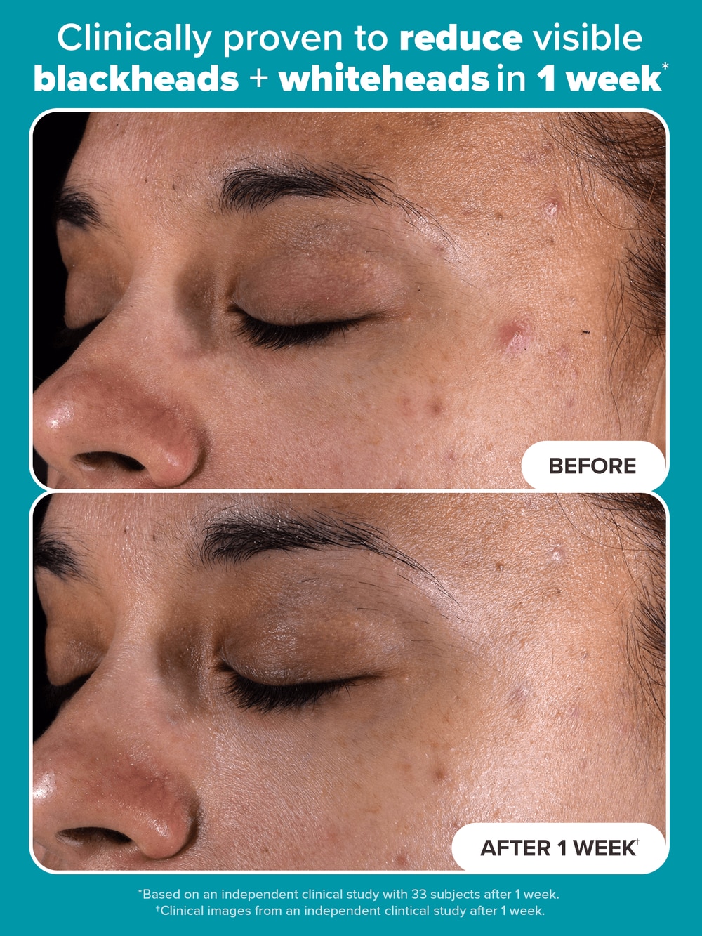 2% BHA Exfoliating Toner Pads