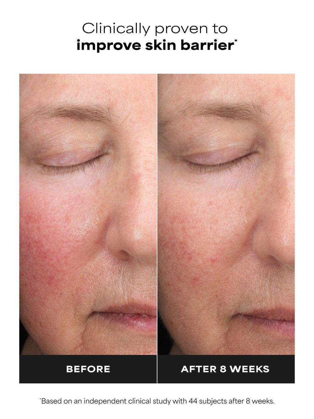 6% Mandelic Acid + 2% Lactic Acid Liquid Exfoliant