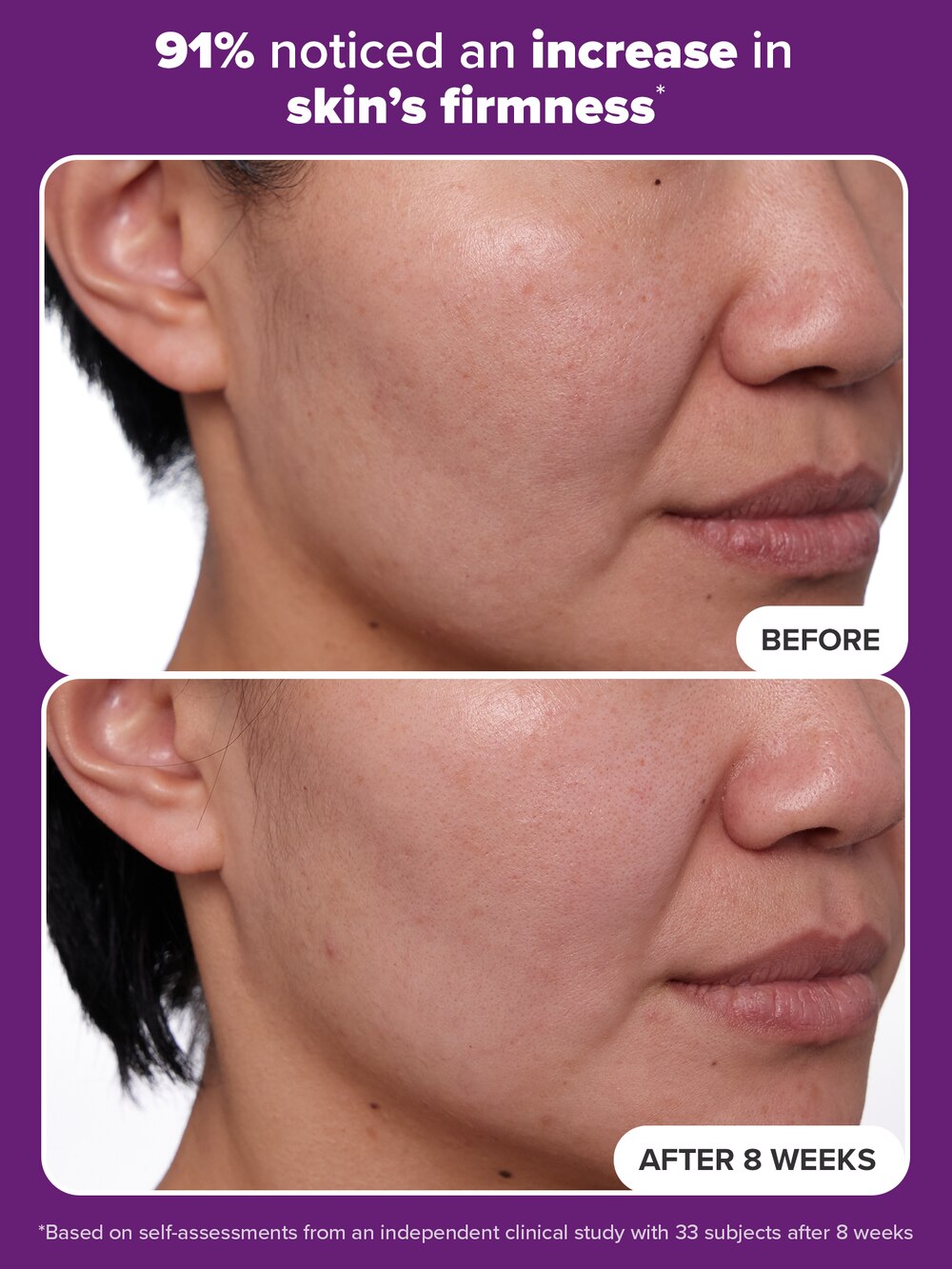 1% Retinol Treatment