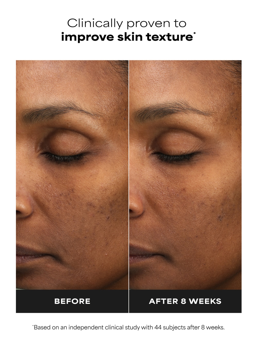 6% Mandelic Acid + 2% Lactic Acid Liquid Exfoliant