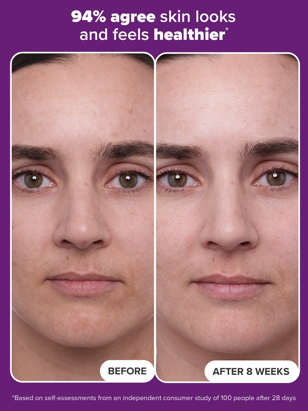 1% Retinol Treatment