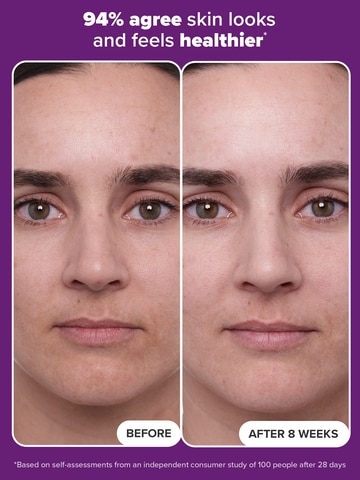 1% Retinol Treatment