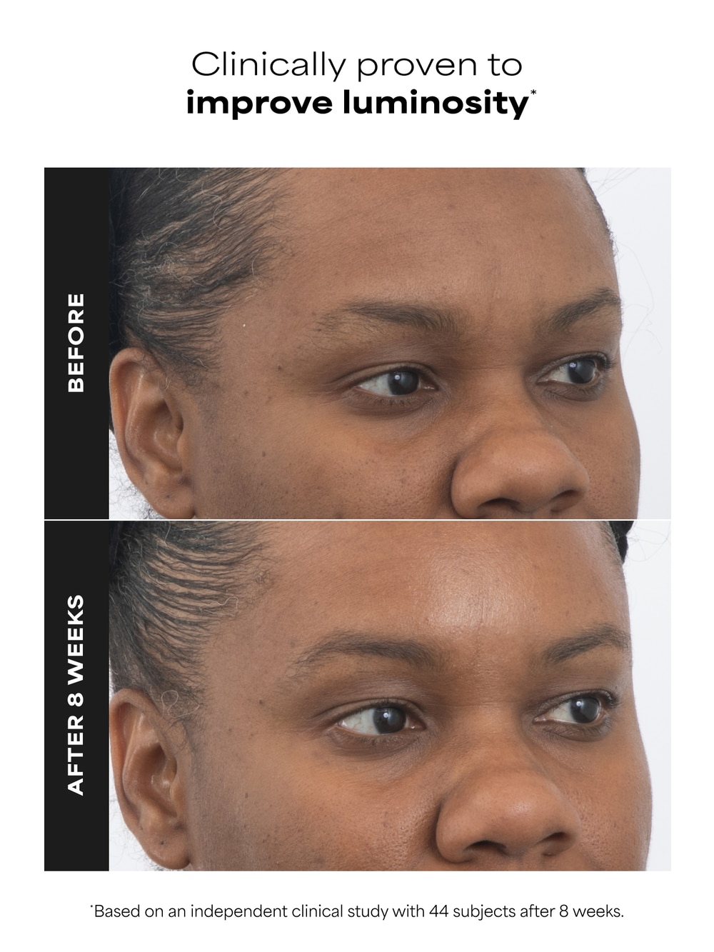 PRO Retinaldehyde Dual-Retinoid Treatment