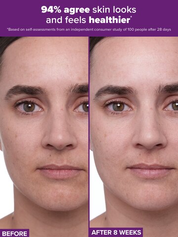 CLINICAL 1% Retinol Serum Treatment + Peptides | Paula’s Choice