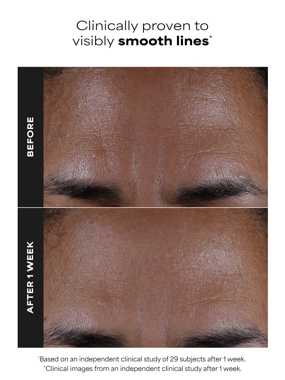 Travel Size 2% BHA Liquid Exfoliant