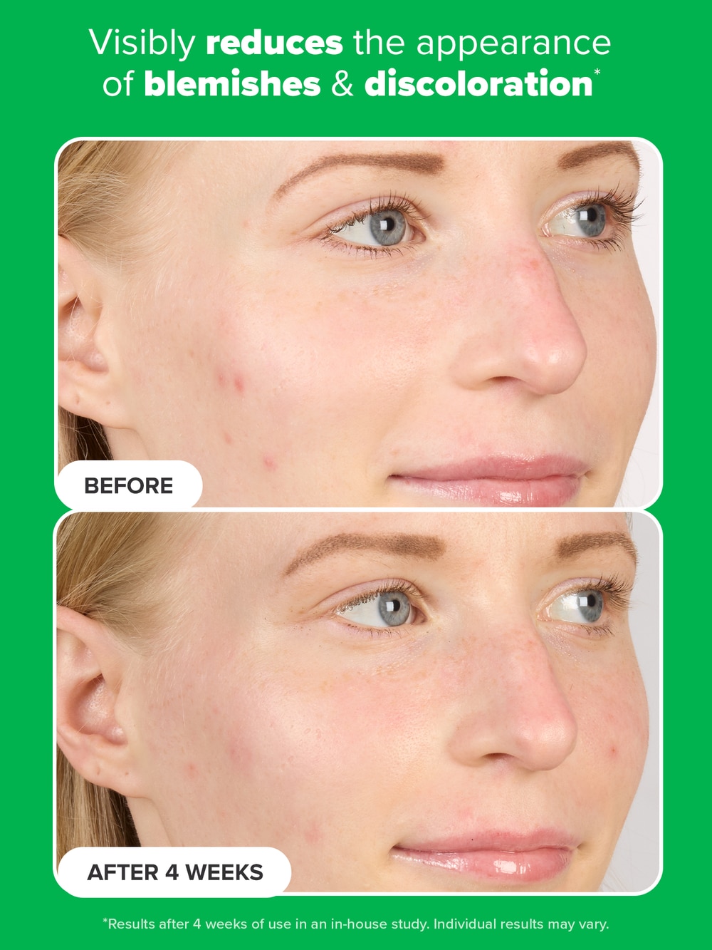 10% Azelaic Acid Booster