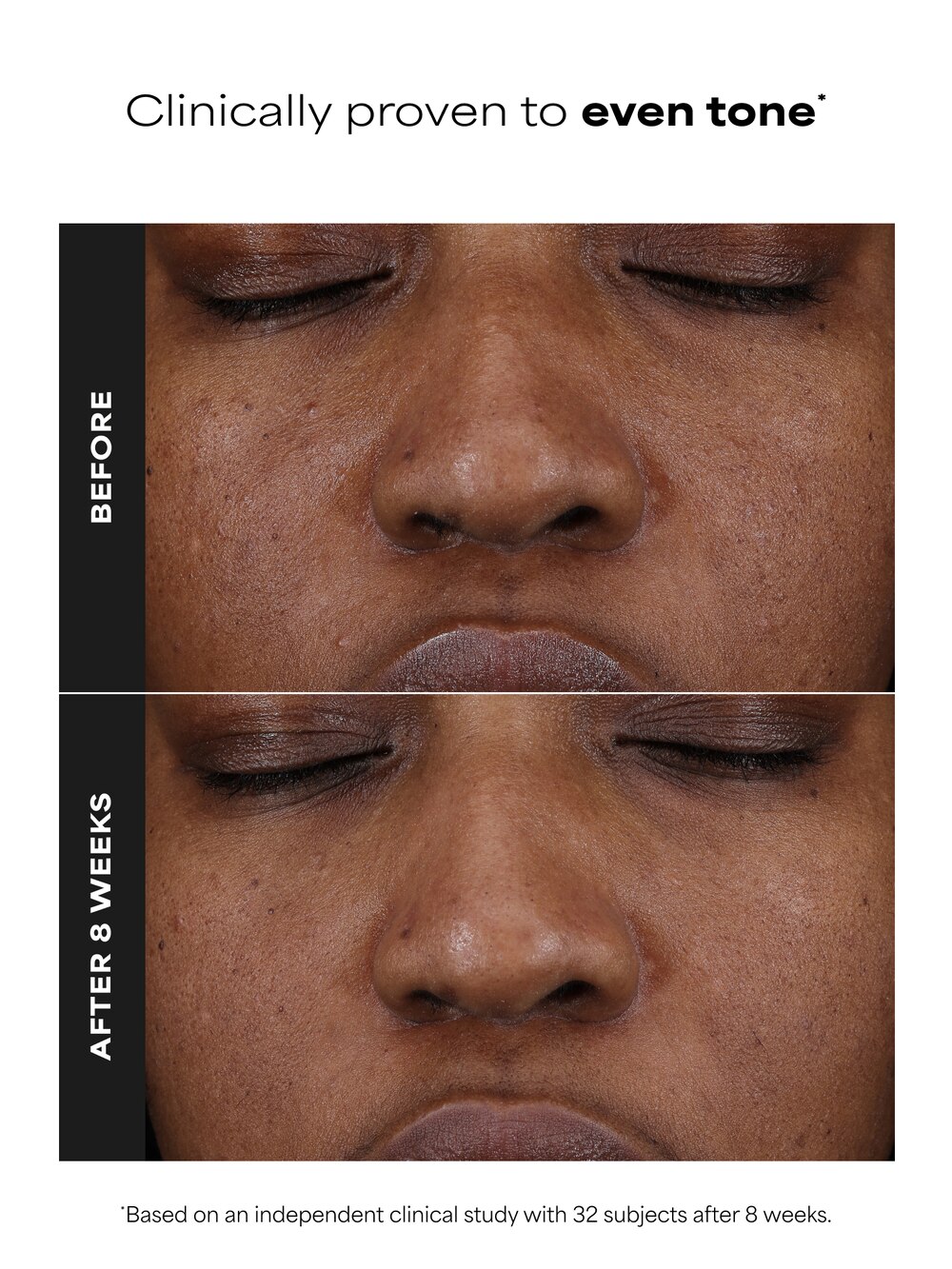 before and after glutathione Glutathione Dark Mark Serum for Hyperpigmentation main image 0