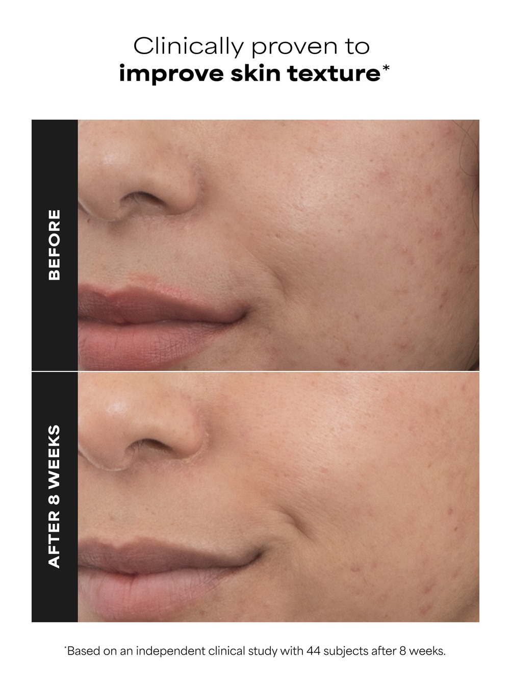 PRO Retinaldehyde Dual-Retinoid Treatment