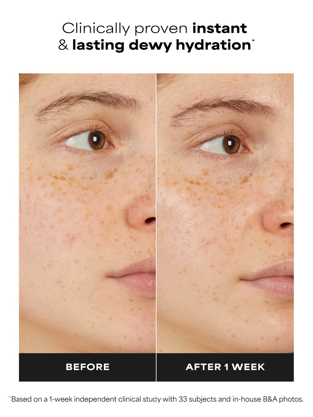 7% Ectoin + Hyaluronic Acid Milky Hydrating Serum