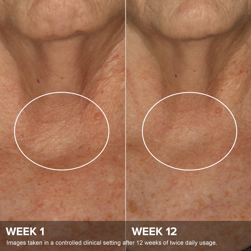 Phytoestrogen Elasticity Renewal Body Treatment