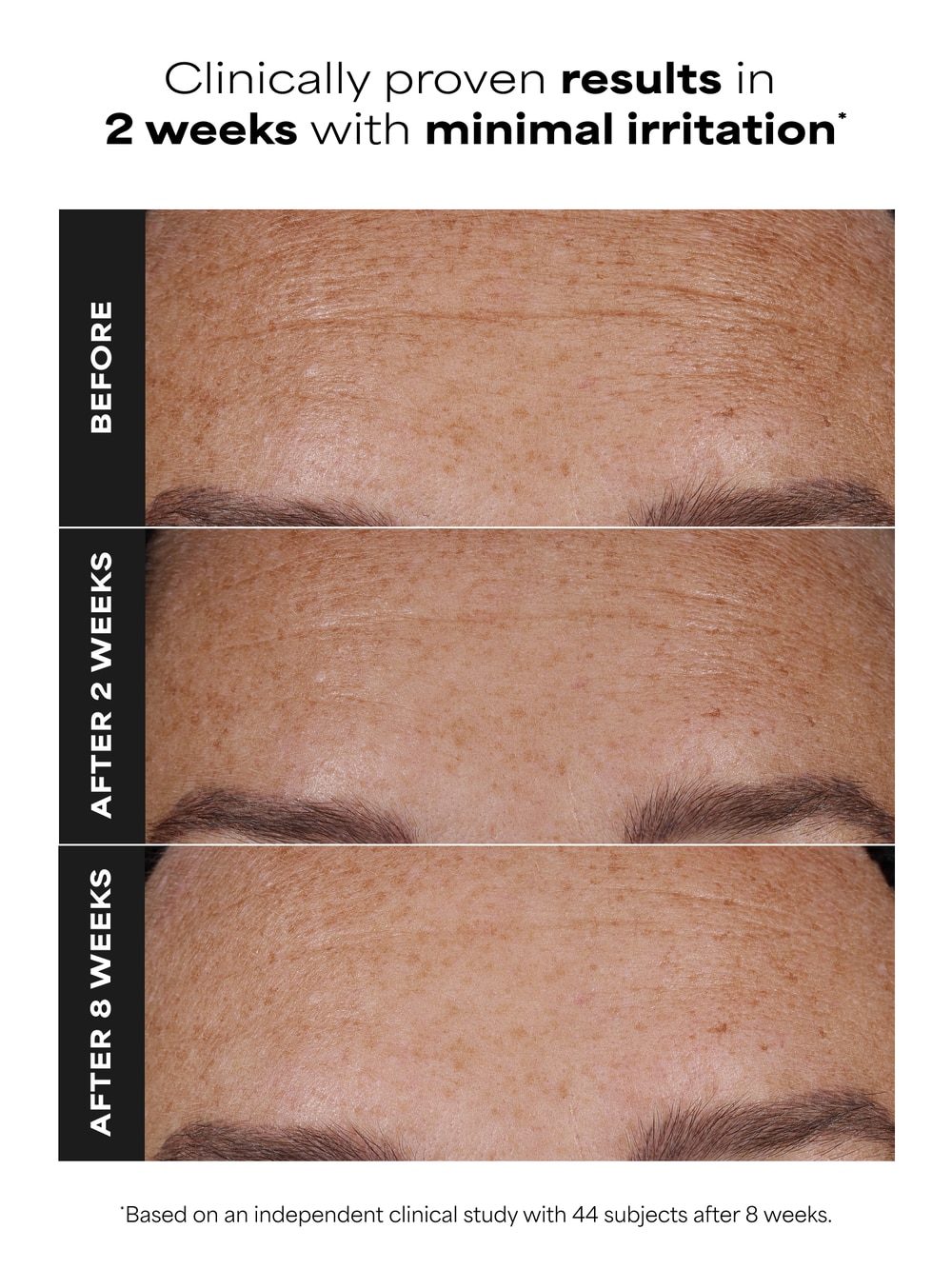 PRO Retinaldehyde Dual-Retinoid Treatment