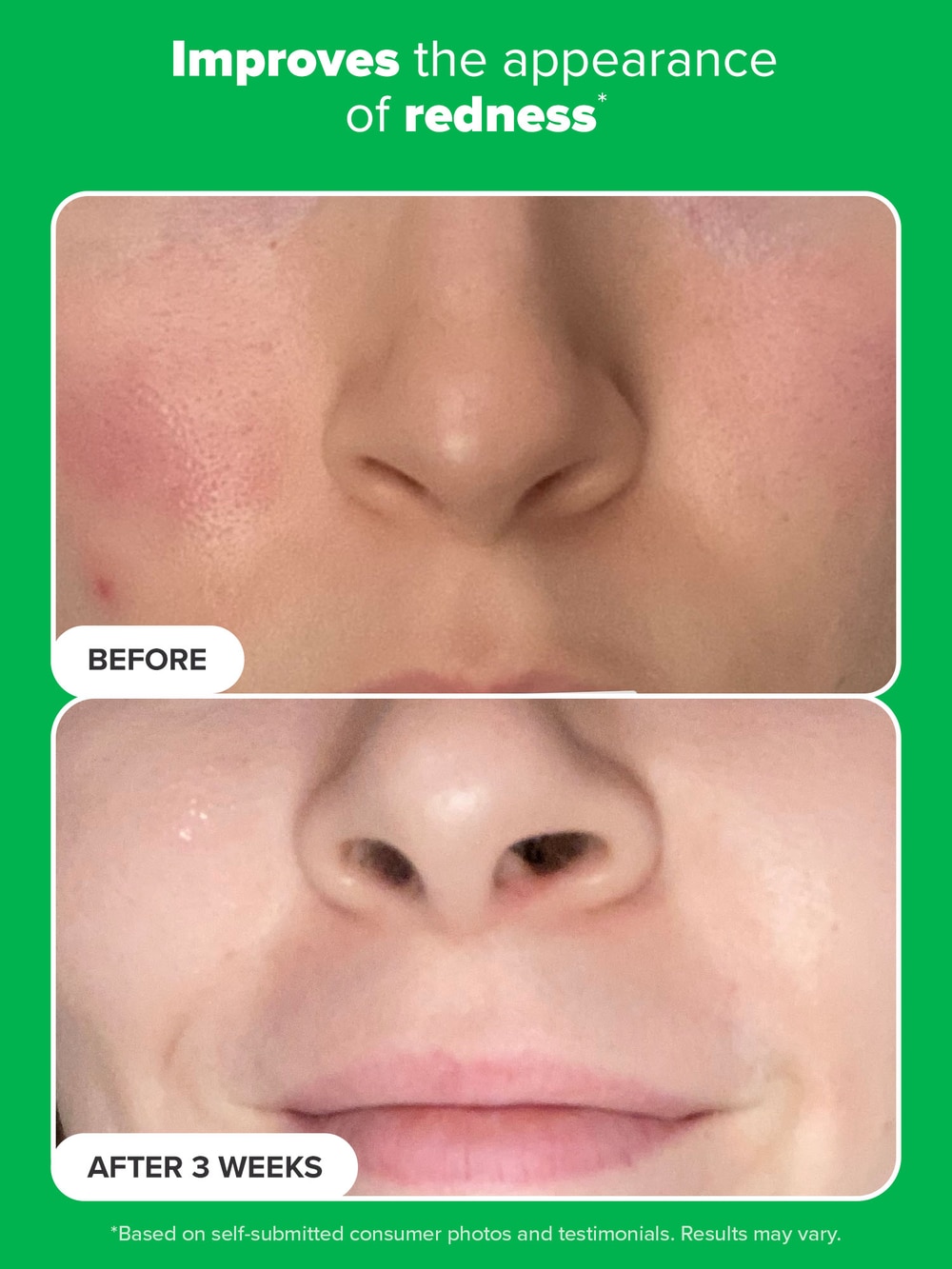 10% Azelaic Acid Booster