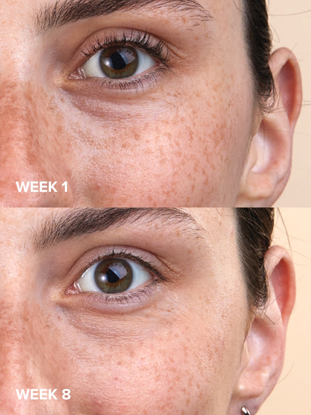 C5 Super Boost Moisturizer