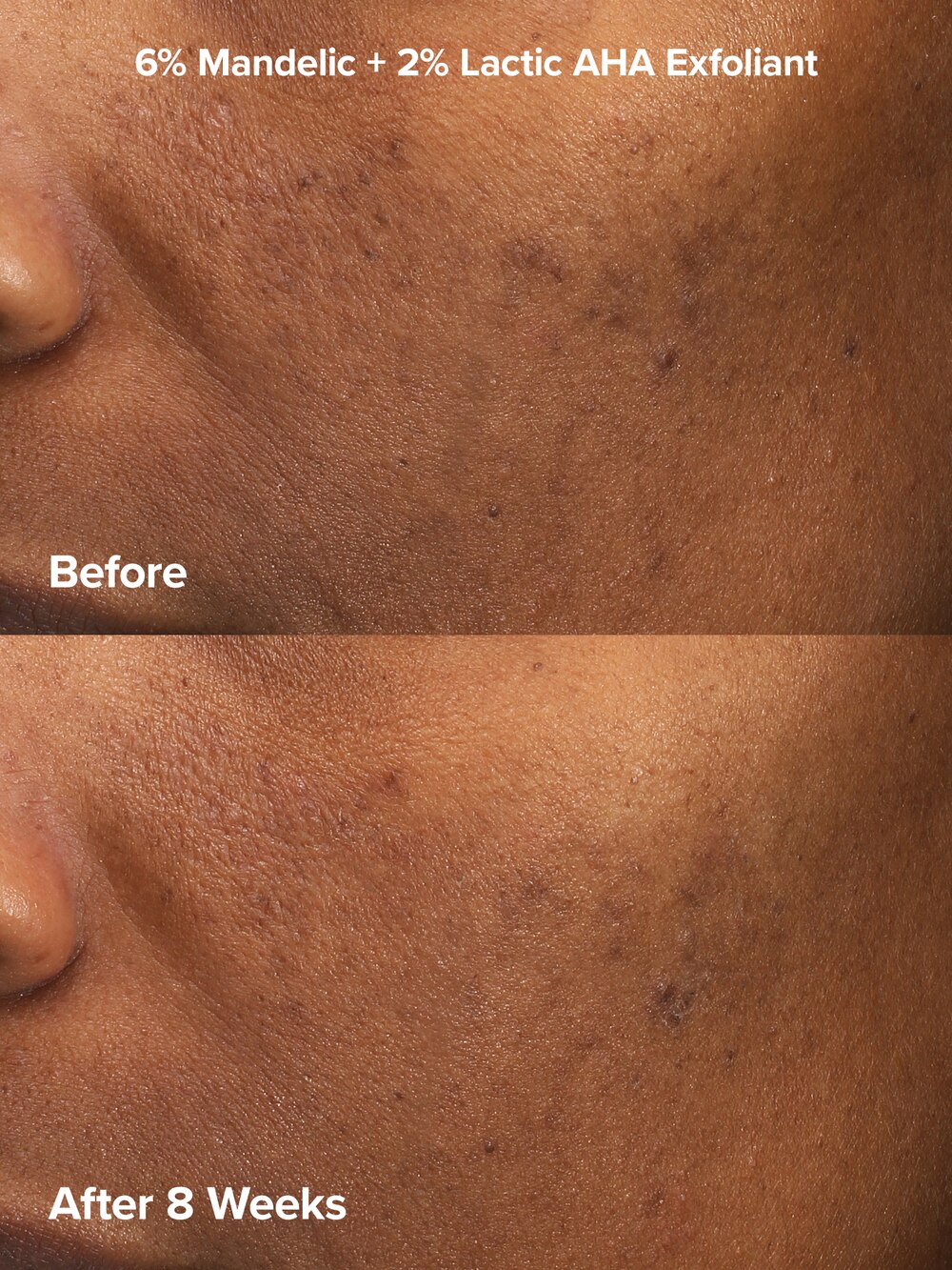 Exfoliation Experience Kit