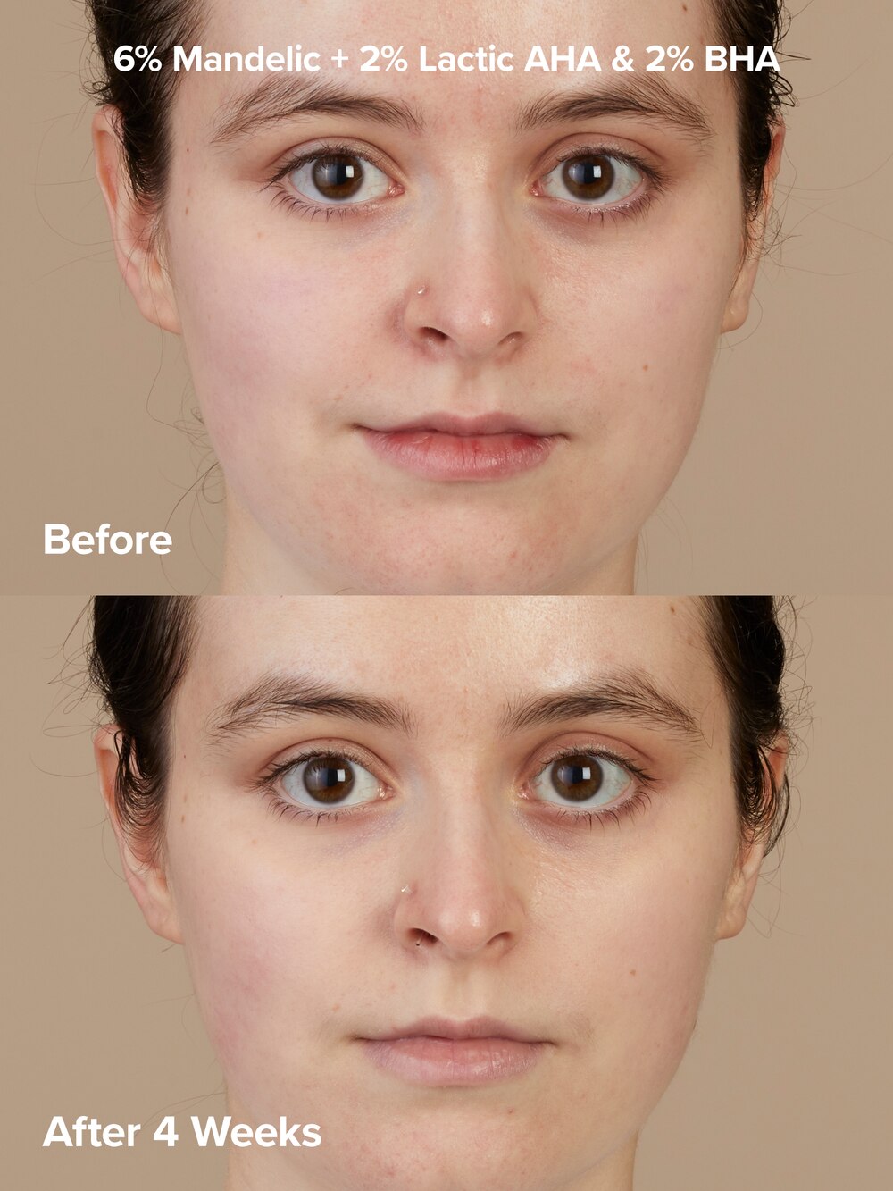 Exfoliation Experience Kit