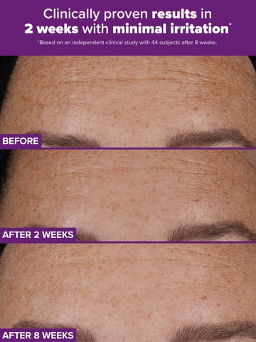 PRO Retinaldehyde Dual-Retinoid Treatment