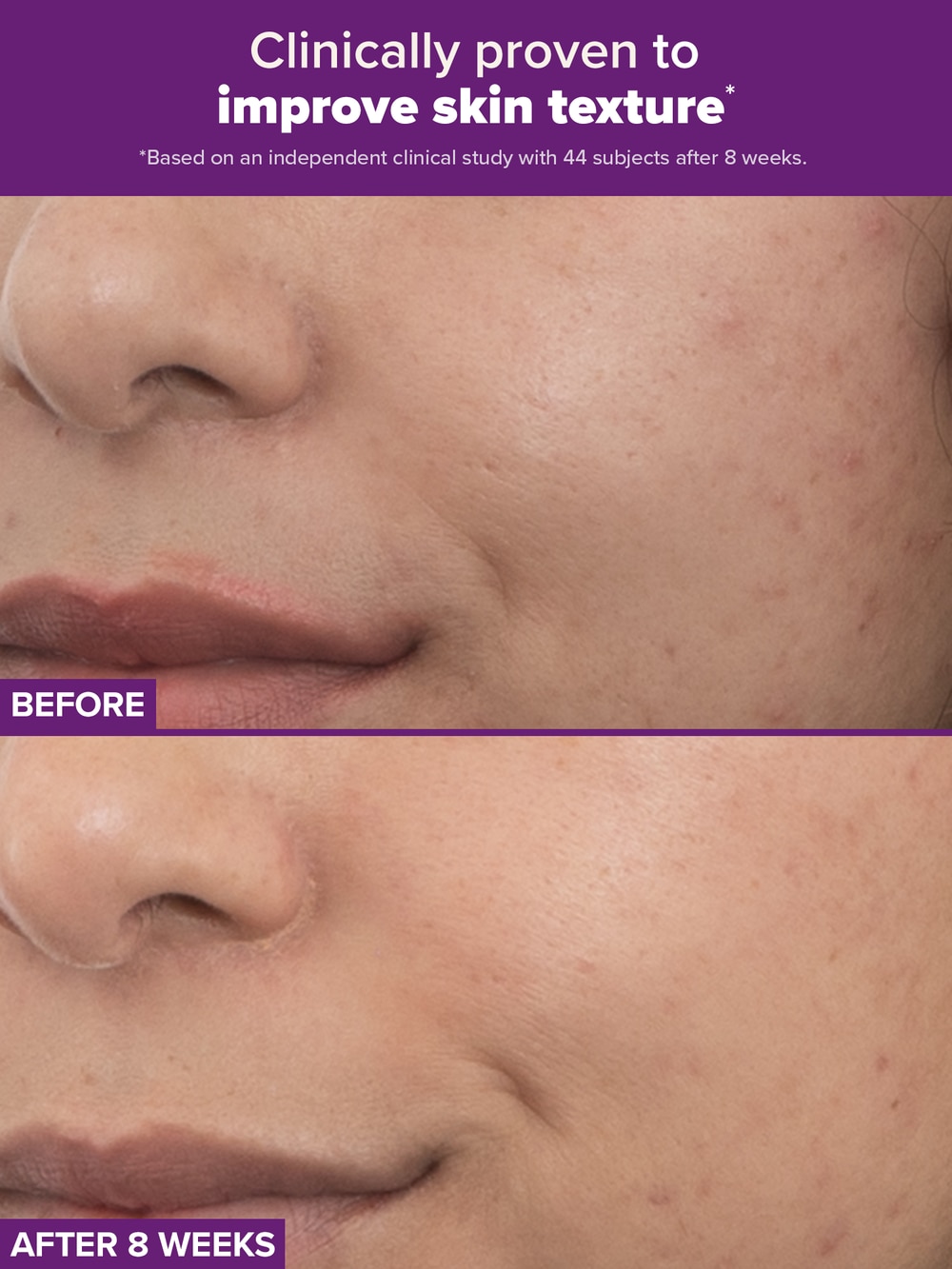 PRO Retinaldehyde Dual-Retinoid Treatment