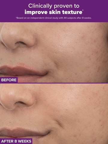 PRO Retinaldehyde Dual-Retinoid Treatment