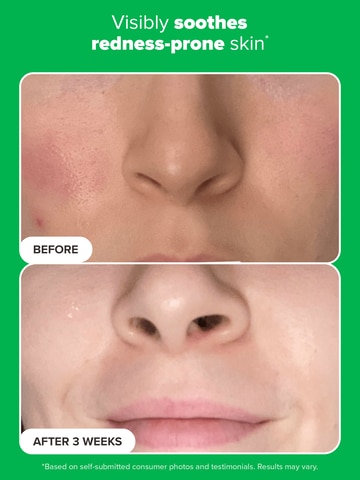 10% Azelaic Acid Booster