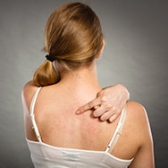 What Causes Bacne