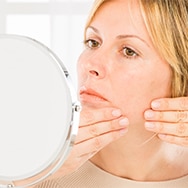 Adult Acne