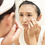Stress and Acne: Does Being Frazzled Cause Breakouts?