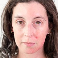 Exfoliation: The Skincare Step You Never Knew You Needed