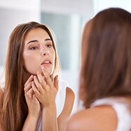 Severe Acne