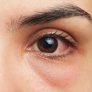 Makeup Tips for Sensitive Eyes