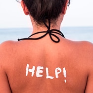 How to Take Care of Sunburned Skin