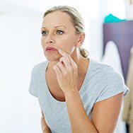 What is “Sun Mustache” & How Do You Get Rid of It?