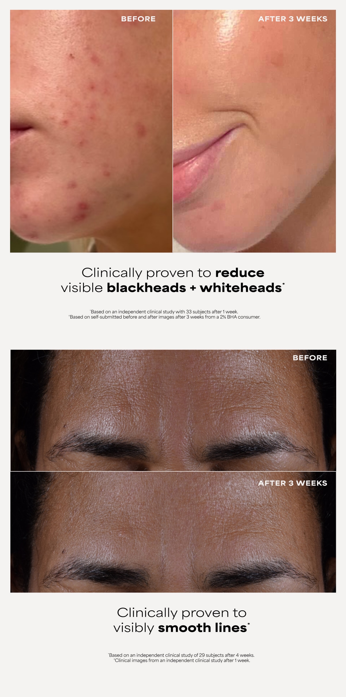 2% BHA Exfoliating Toner Bundle for Clearer Skin | Paula's Choice