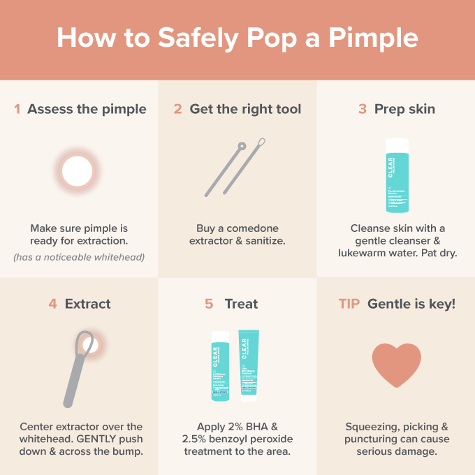 Aftensmad Gennemsigtig Indsprøjtning How to Pop a Pimple the Right Way | Paula's Choice