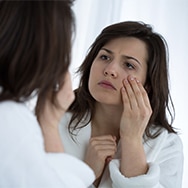 What Causes Dark Circles?