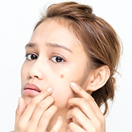 How to Make a Pimple Go Away Fast